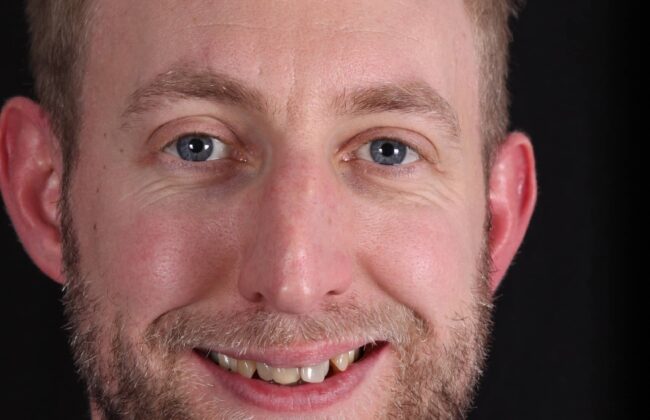 Before (Teeth)