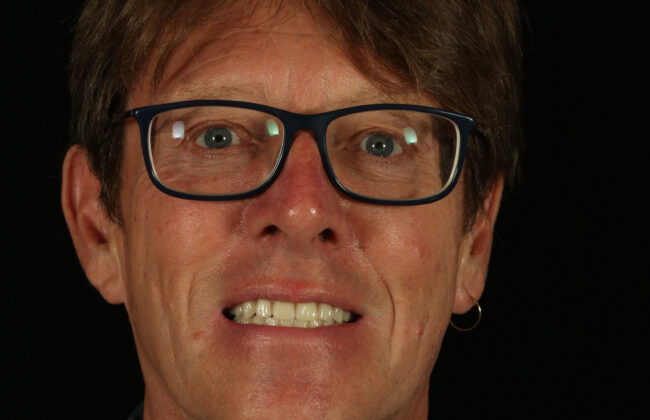 After (Teeth)