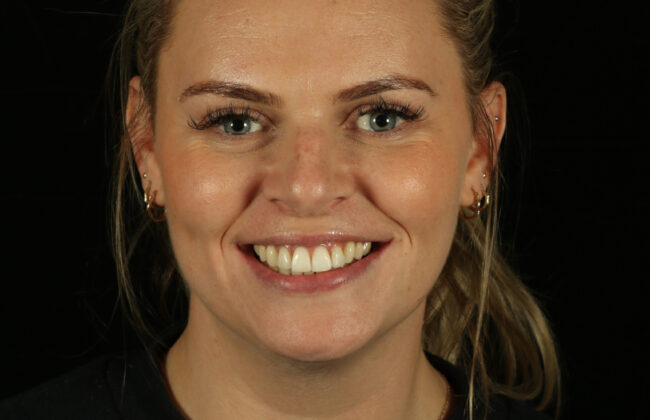 After (Teeth)