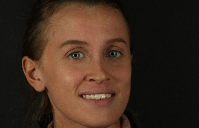 Before (Teeth)