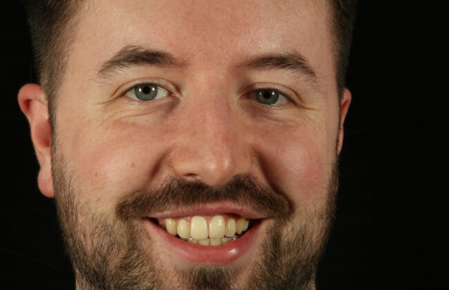 After (Teeth)