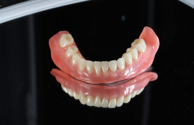 Before (Teeth)