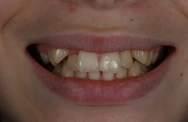 Before