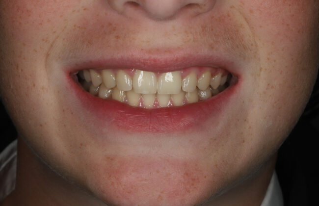 After