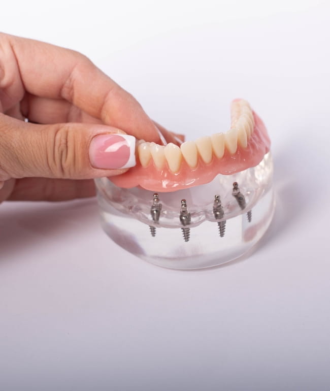 Treatments - Smile Society