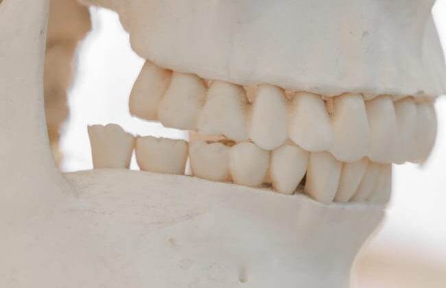 Before (Teeth)