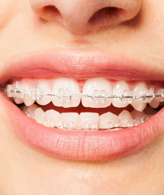 Treatments - Smile Society