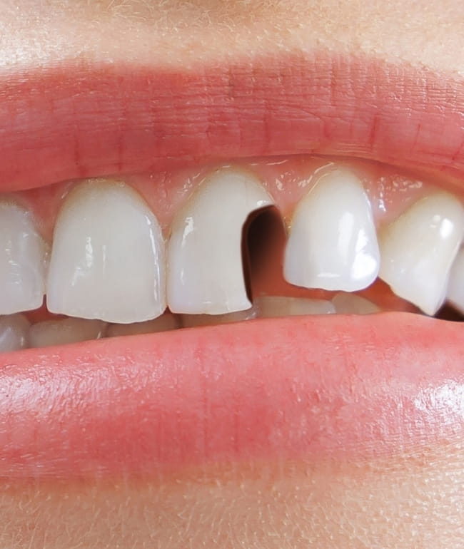 Treatments - Smile Society