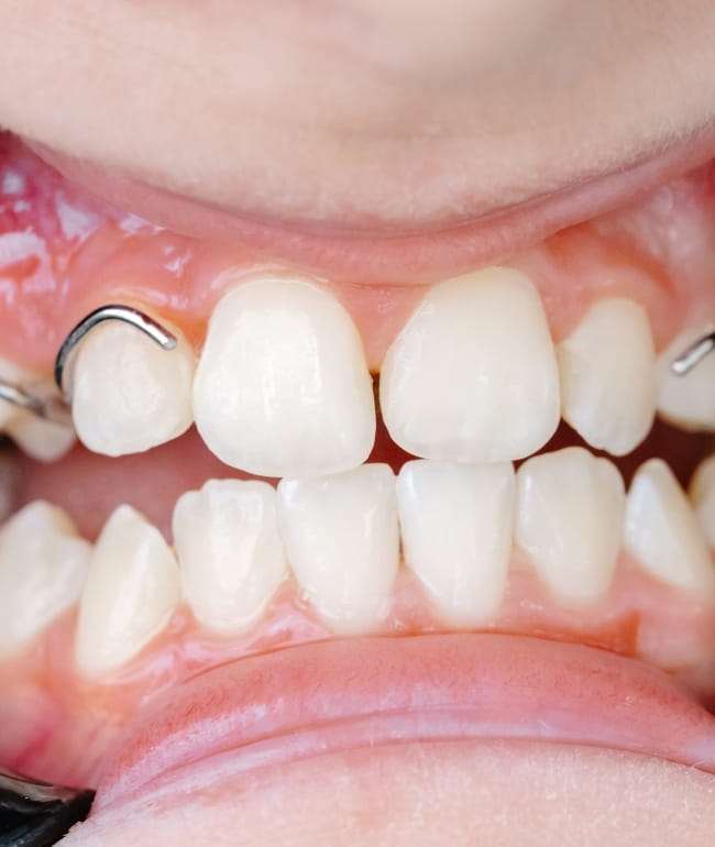 Treatments - Smile Society
