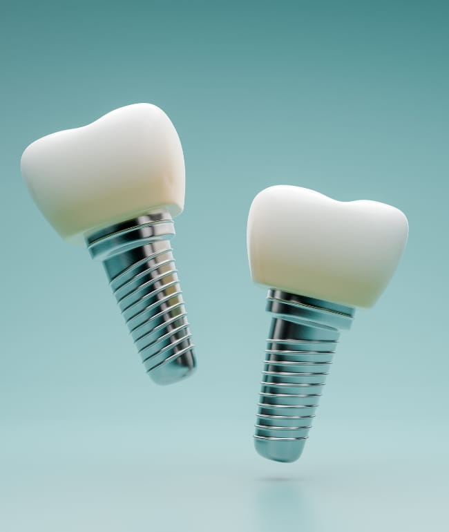 Treatments - Smile Society