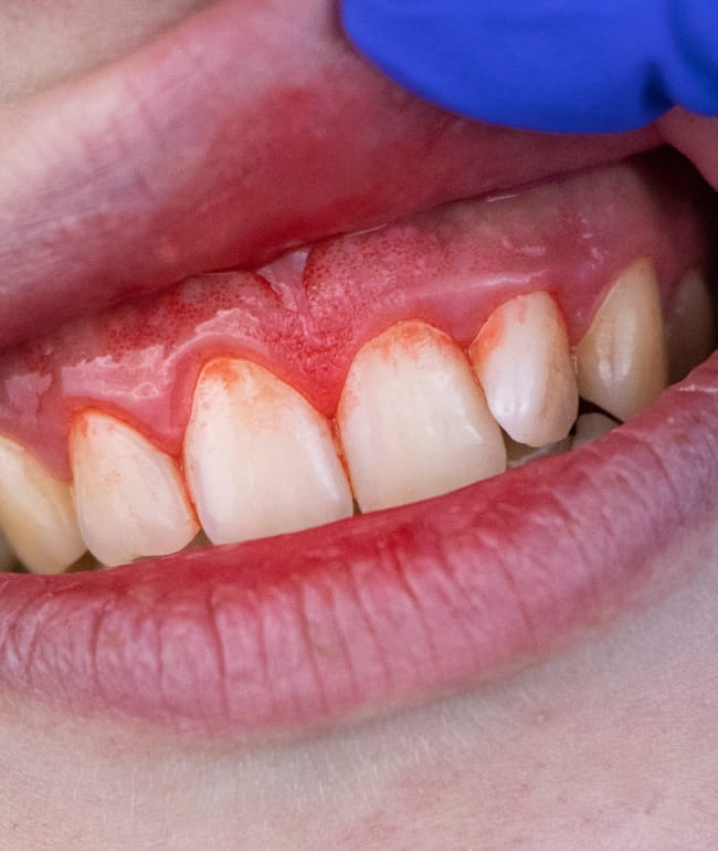 Treatments - Smile Society