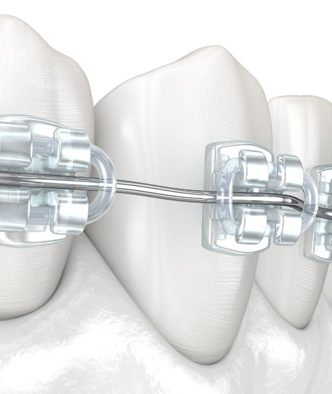 Treatments - Smile Society