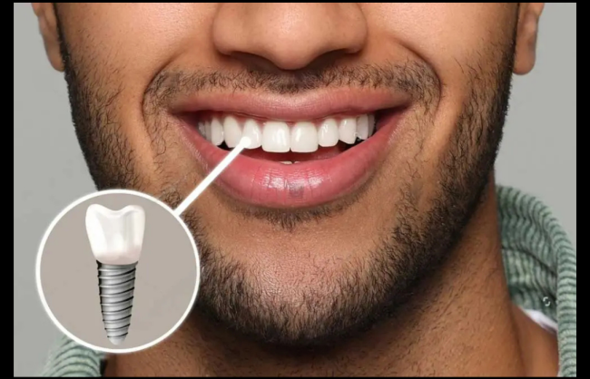 Blog - Smile Society